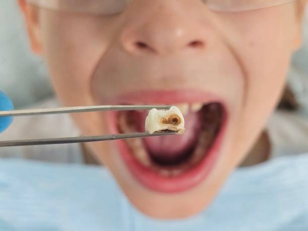 Best Pediatric Emergency Dentist in Daytona Beach, FL